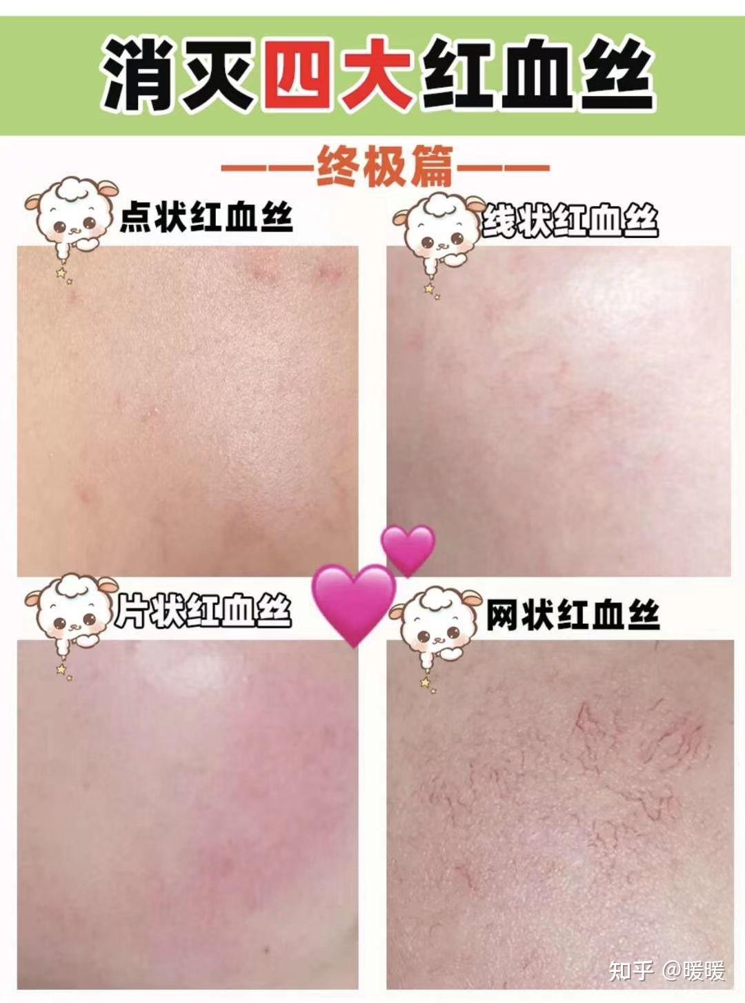 白羊座和什么座最搭配